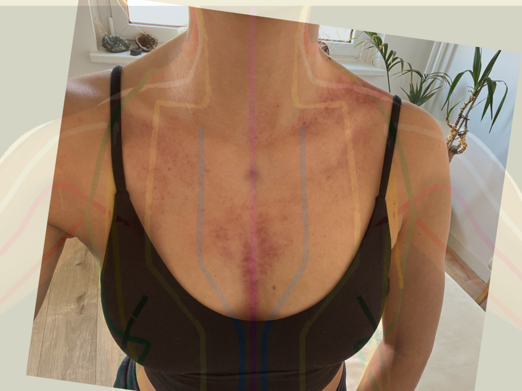 Transformational cupping Cup of QI